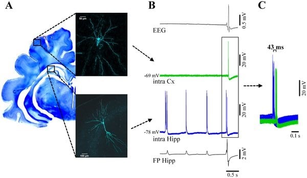 This image shows ortical and hippocampal neuronal activity during νC state. The caption best describes the image.