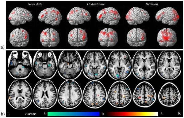 The image shows the brain scans associated with the research. The caption best describes the image.