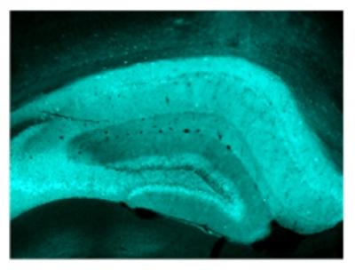 This is an image of a mouse hippocampus.