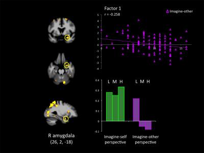 The image shows an fMRI of a psychopath's brain. The caption best describes the image.