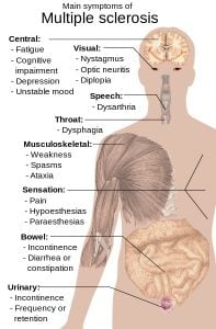 This illustration shows the main symptoms of multiple sclerosis.