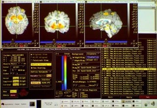 The image shows the MRI brain scans used in this study.