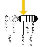 The image show the location of SOD1 on chromosome 21.