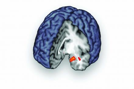 The image shows the opiod system in the brain.