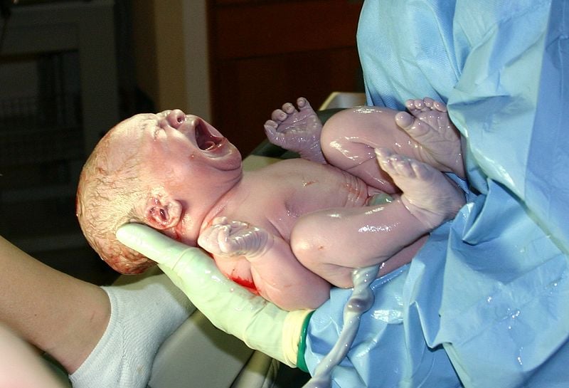 This is a newborn baby.