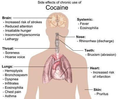 The image details the effects of cocaine on body.