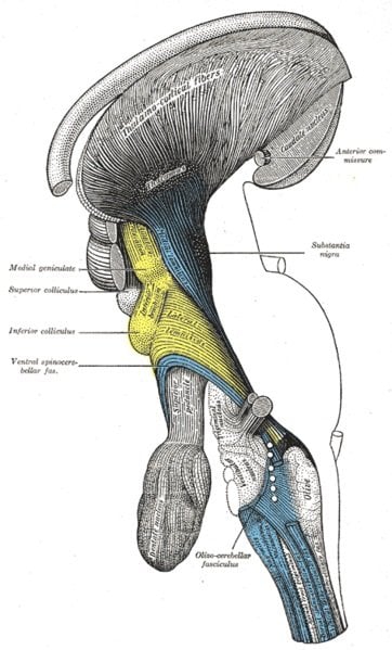 The image shows a deep dissection of brain-stem. Lateral view. The "Inferior colliculus" is yellow, and is labeled at left.