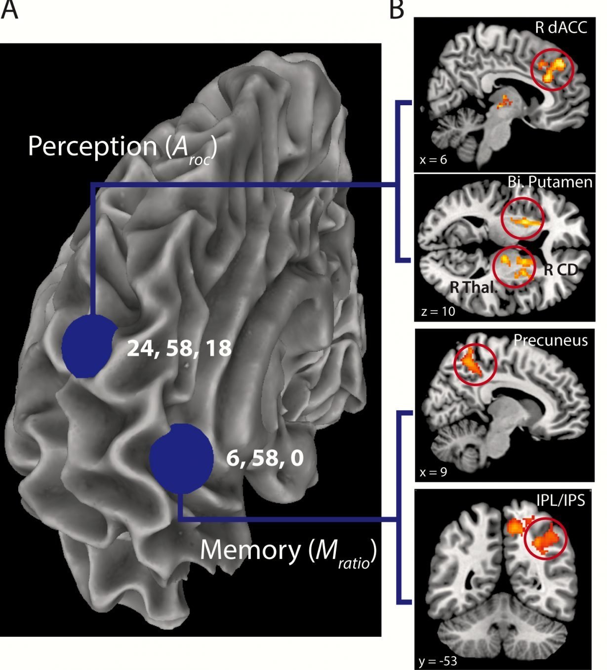 The image shows the fMRI results for the study. The caption best describes the image.