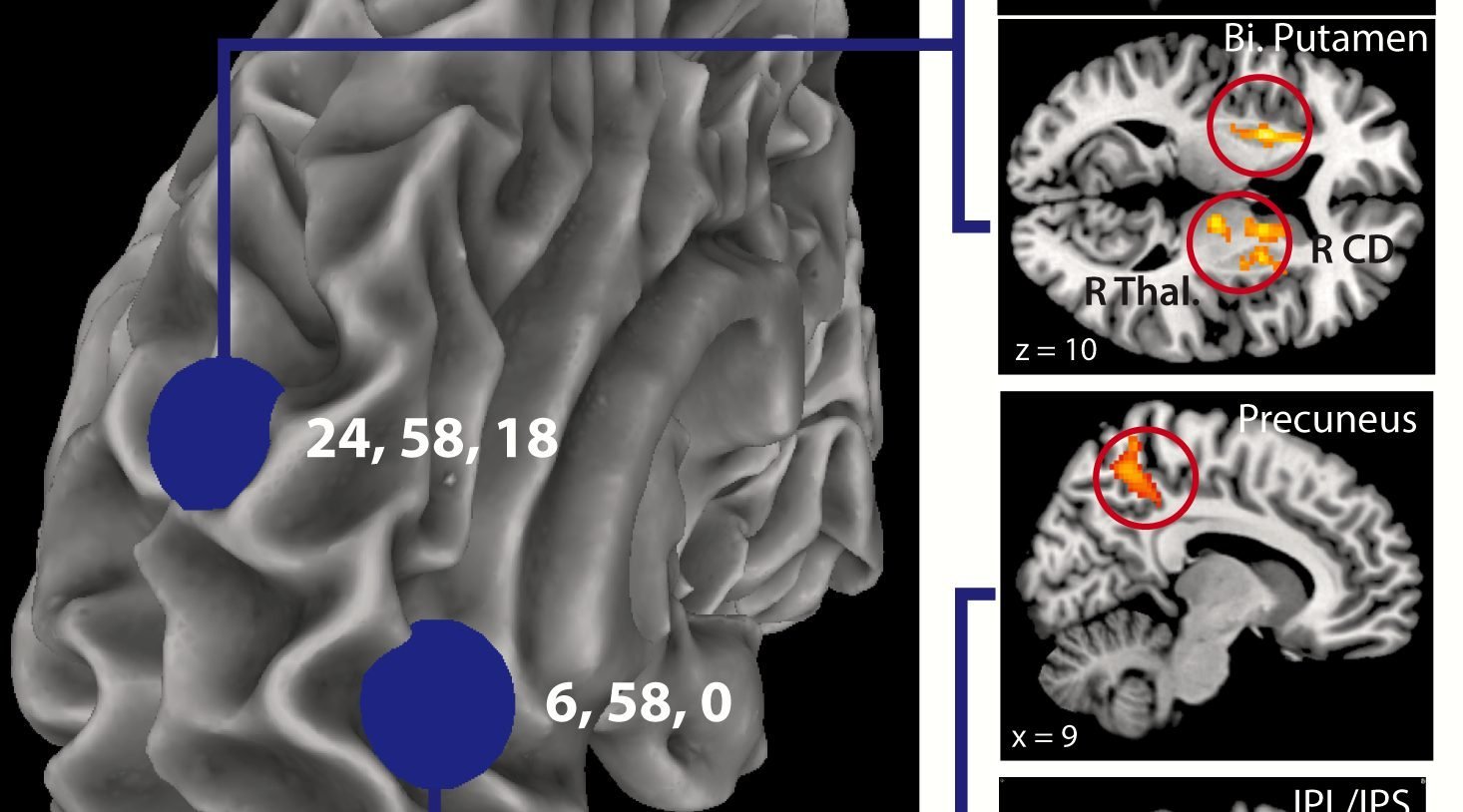 The image shows the fMRI results for the study. The caption best describes the image.