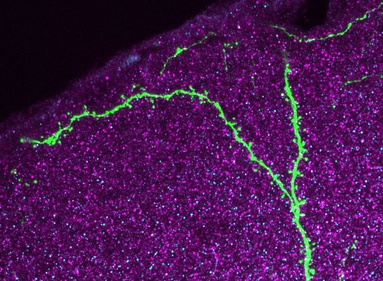 The image shows neurons in the auditory cortex of a mouse
