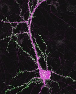 Fluorescence image of a neuron labeled for synapses (green) and cell structure (magenta).