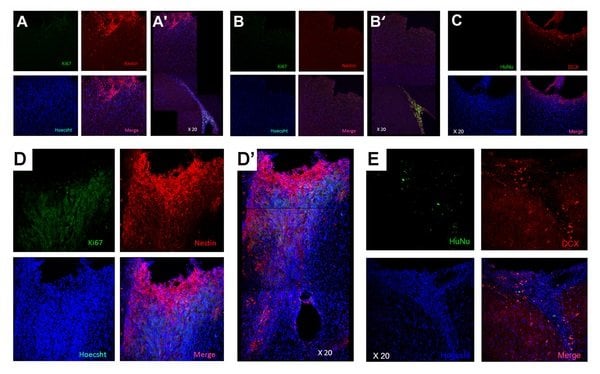 The image shows electrophysiology slides associated with the research.