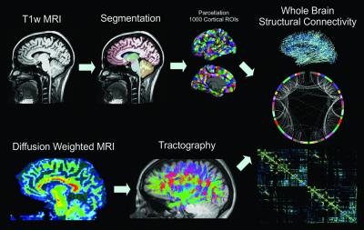 The image shows brain scans for the epilepsy patients.