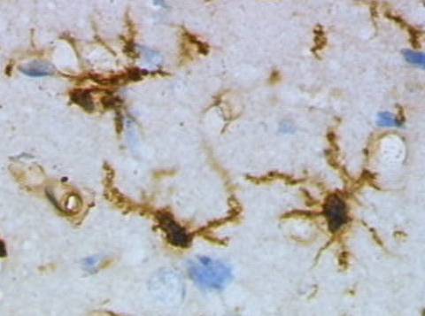 The image shows a microglia.
