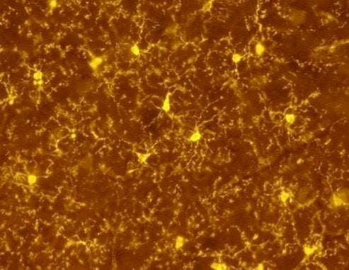 These are microglia cells.