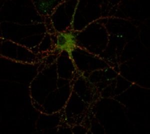 This is a neuron in the hippocampus stained for RIM1 and SUMO.