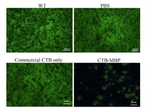 The image shows comparison slides from this alzheimer's study.