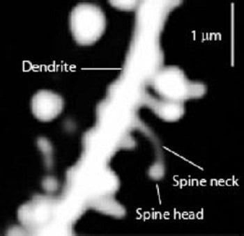 These are dendritic spines.