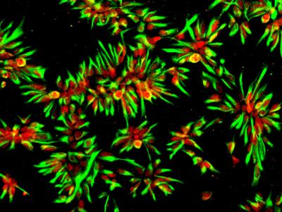 The image shows the stained neural stem cells.