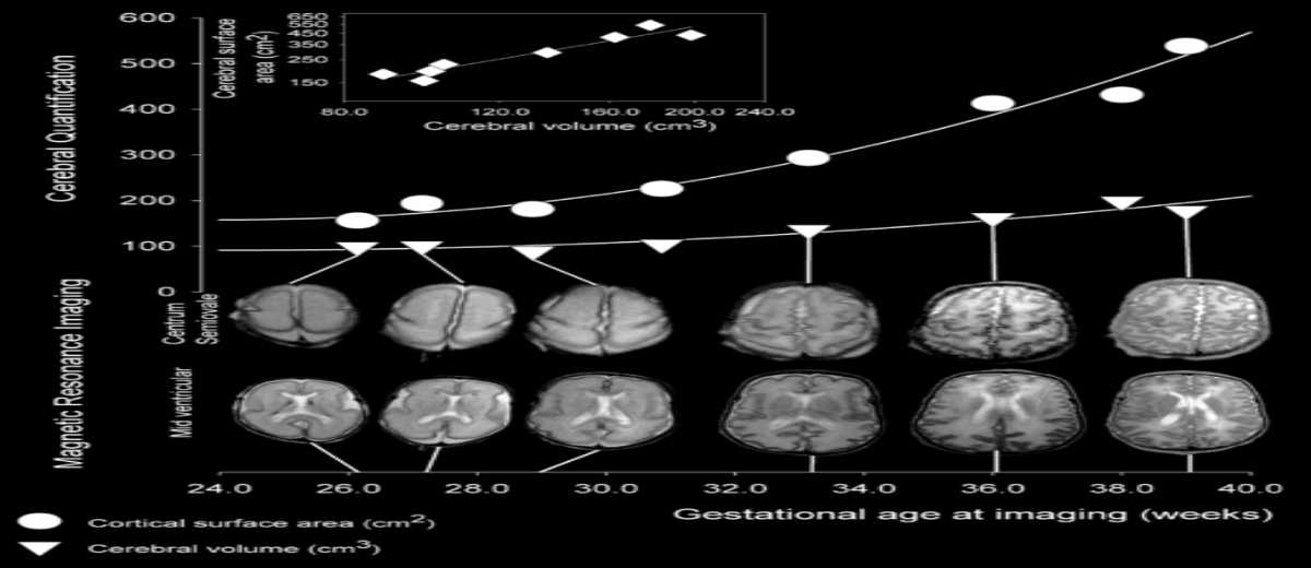 The genetic architecture of the human cerebral cortex