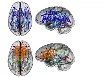 The image shows the different mapping in the brain scans between men and women.