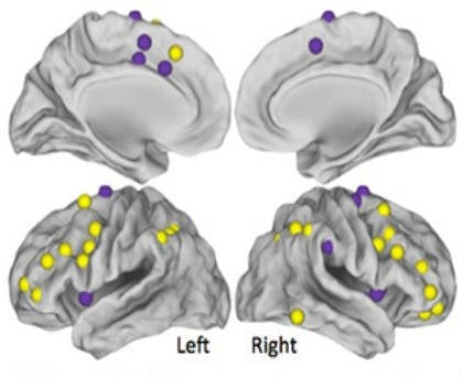 These are the MRI images of the chemobrain patients.