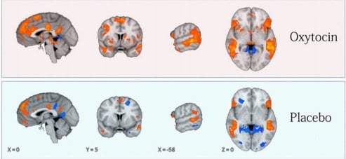 These brain scans shows the impact of oxytocin.