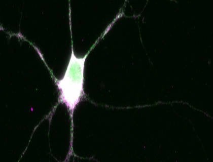 This is a neuron.
