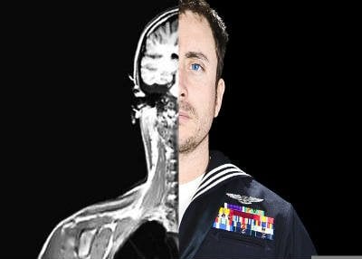The image is a self portrait of Jonathan David Chandler. One half of the image shows him in his military uniform and was taken while receiving treatment for TBI suffered while serving in Afghanistan. The second half is an MRI scan.