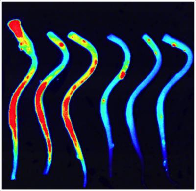 This image shows thombin in the spinal cord.