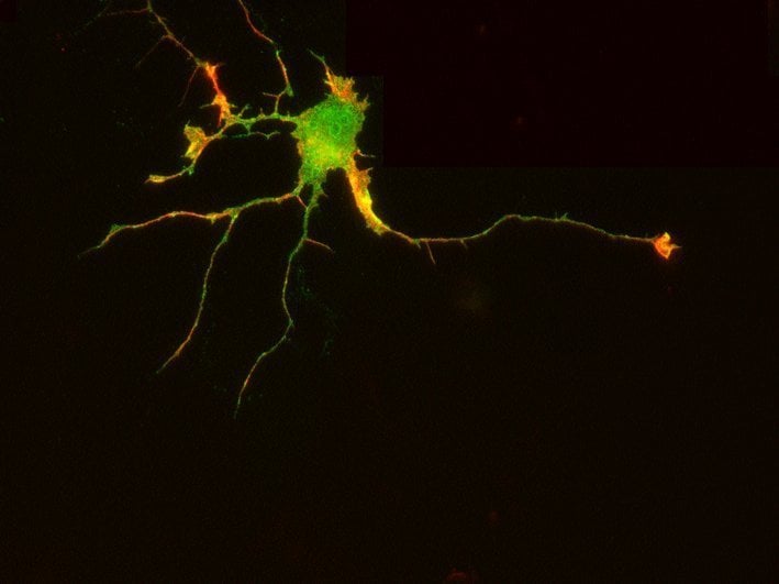 The image shows eph receptors in a neuron's surface.