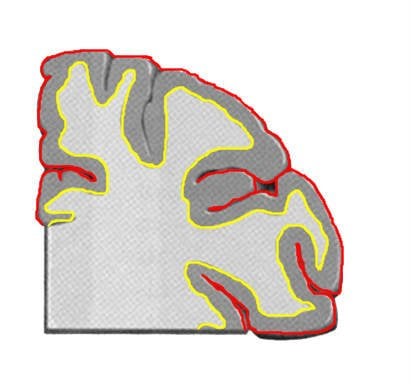 This is the human cerebral cortex slice.