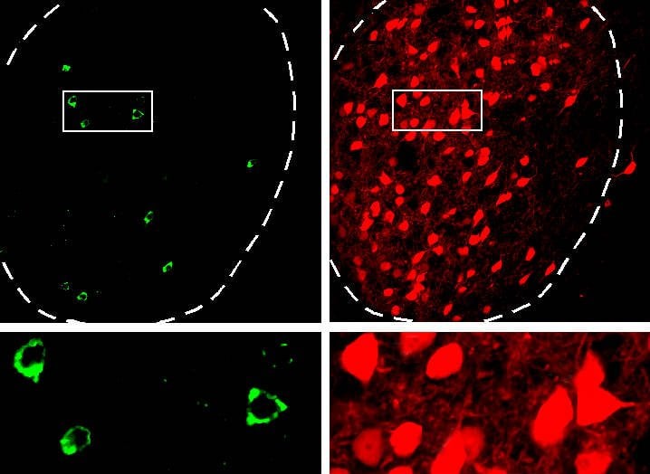 The image shows neurons in the amgydala and brain stem.