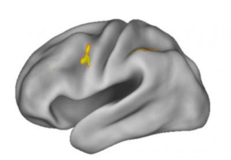 The image shows the location of the dorsal anterior premotor cortex in the brain.