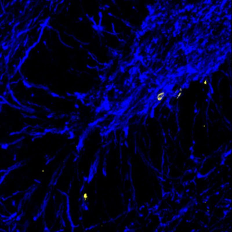 The image shows myelin, stained in blue, in a rat's hippocampus.