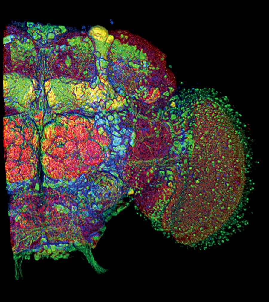 The image higlights the difference proteins in the fly brain.