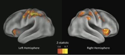 These MRI scans show the predictive regions of the brain reported in the research.
