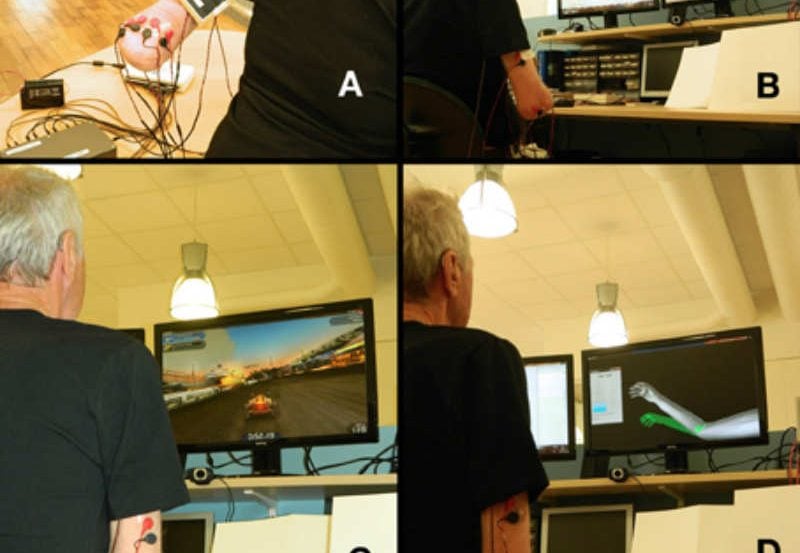 The image shows four different aspects of the patient using the arm to control a video game.