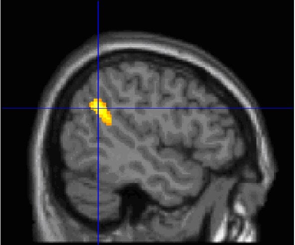 This scan shows the location of the TPJ in the human brain.