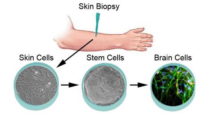 This diagram takes you through step by step how iPSCs become neurons.