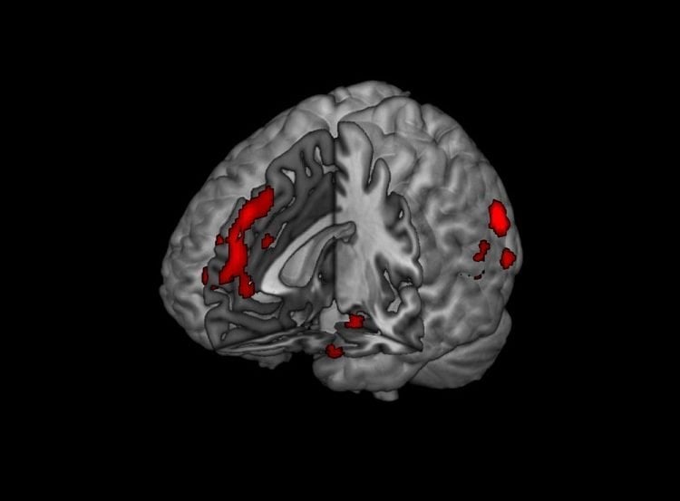 The fmri brain scan image shows the areas affected when making a moral judgement.