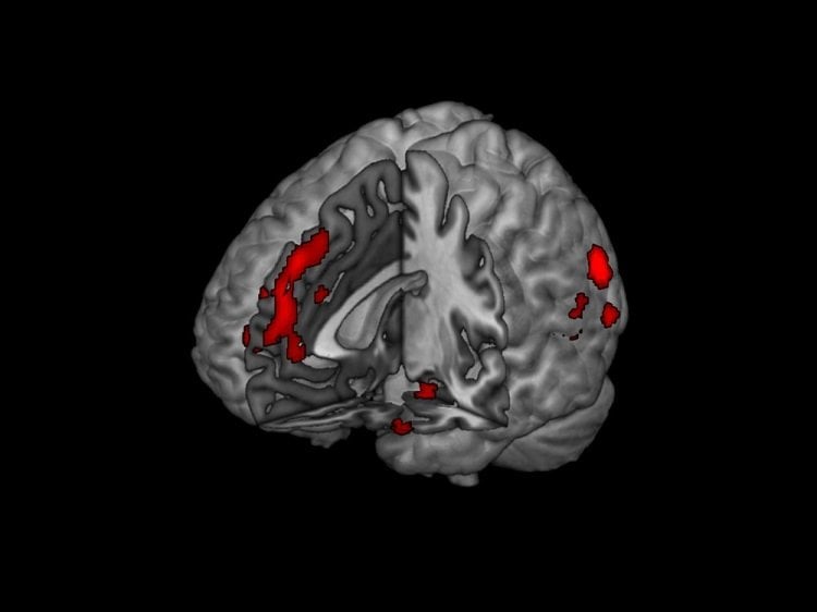 The fmri brain scan image shows the areas affected when making a moral judgement.