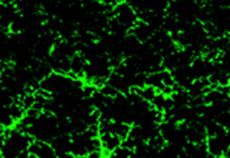 This image shows microglia in green.