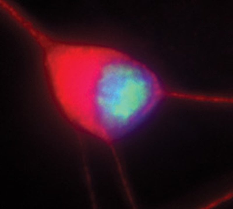 This image shows a motor neuron which was created from stem cells.