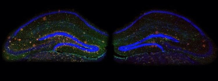 The image shows an hippocampal slice from a mouse. The caption best describes the image.