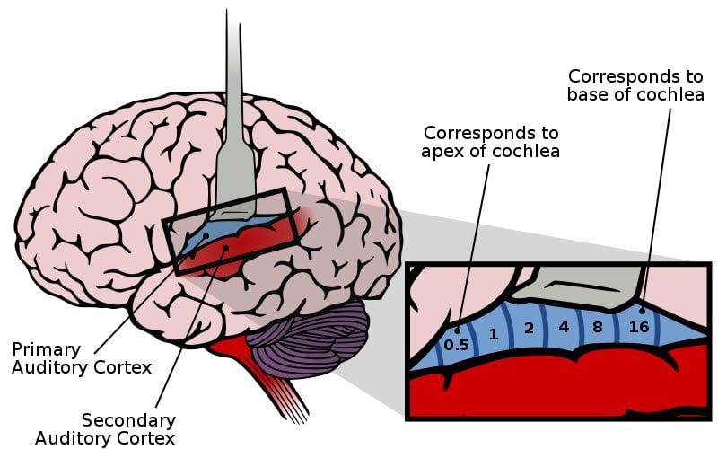 The image shows the location of the auditory cortex in the brain.