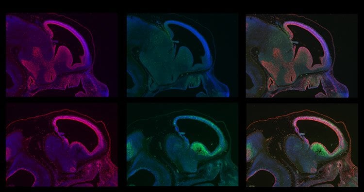 The image shows early developmental differences between normal and BRAC1 deficient brains.