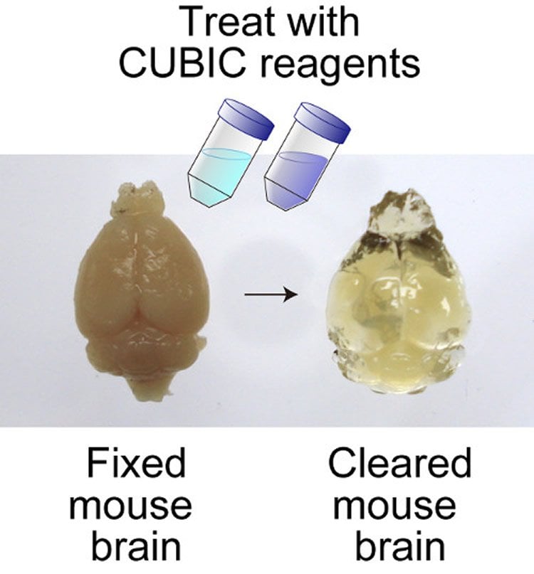 The image shows an mouse brain and a clear, jelly looking mouse brain.