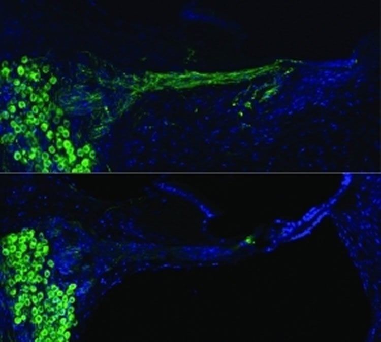 This image shows regenerated auditory neurons using gene therapy.