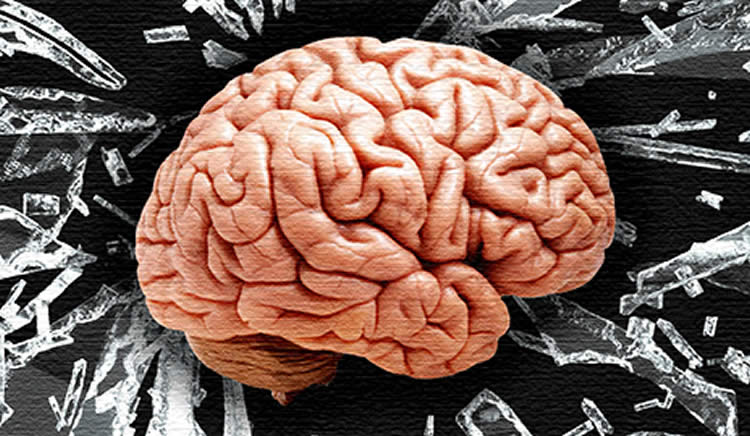 This image shows a brain with a broken glass background.